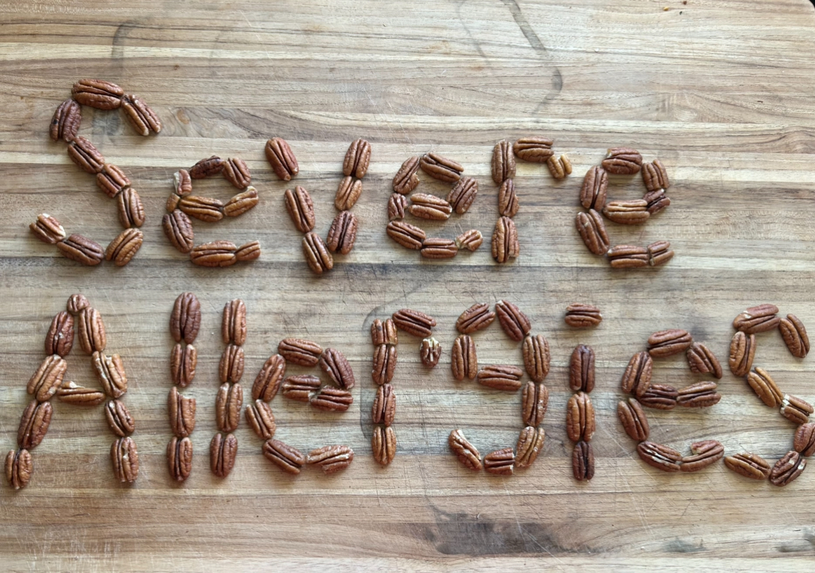 One of the most common food allergies is nuts. 